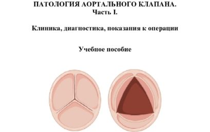 Патология аортального клапана. Клиника, диагностика, показания к операции: учебное пособие.