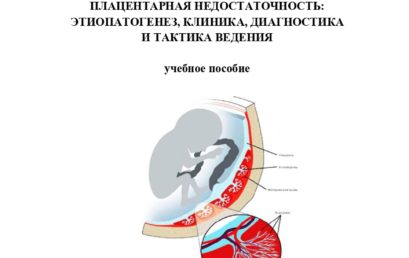 Плацентарная недостаточность: этиопатогенез, клиника, диагностика и тактика ведения: учебное пособие.