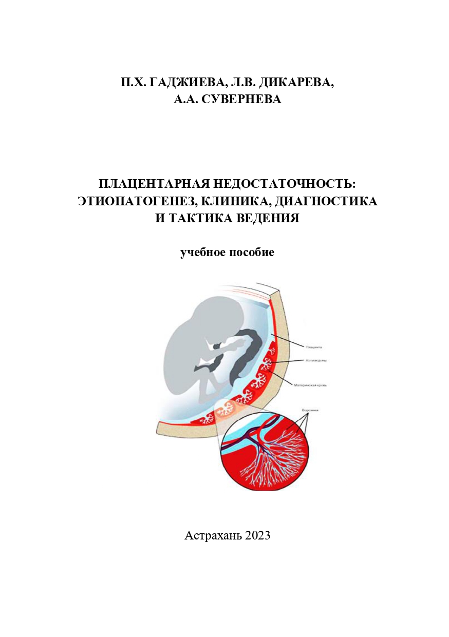 Плацентарная недостаточность: этиопатогенез, клиника, диагностика и тактика ведения: учебное пособие.