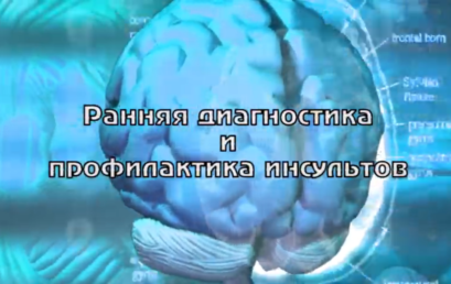 “Просто о сложном”: ранняя диагностика и профилактика инсультов