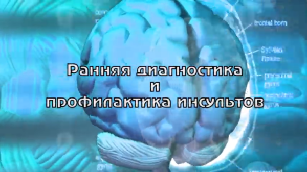 “Просто о сложном”: ранняя диагностика и профилактика инсультов