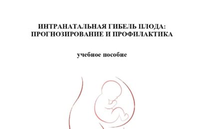 Интранатальная гибель плода: прогнозирование и профилактика: учебное пособие.