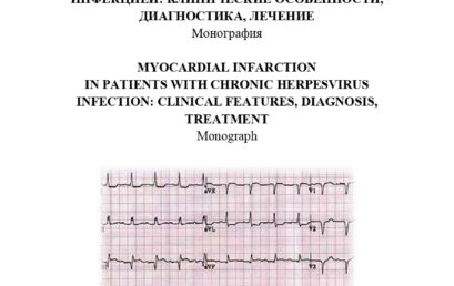 Инфаркт миокарда у больных хронической герпесвирусной инфекцией: клиника, диагностика, лечение: монография.