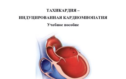 Тахикардия – индуцированная кардиомиопатия: учебное пособие.