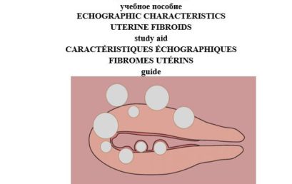 Эхографическая характеристика миомы матки: учебное пособие.